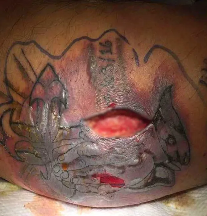 Dövme yaptırdılar sonucu bakın ne oldu!