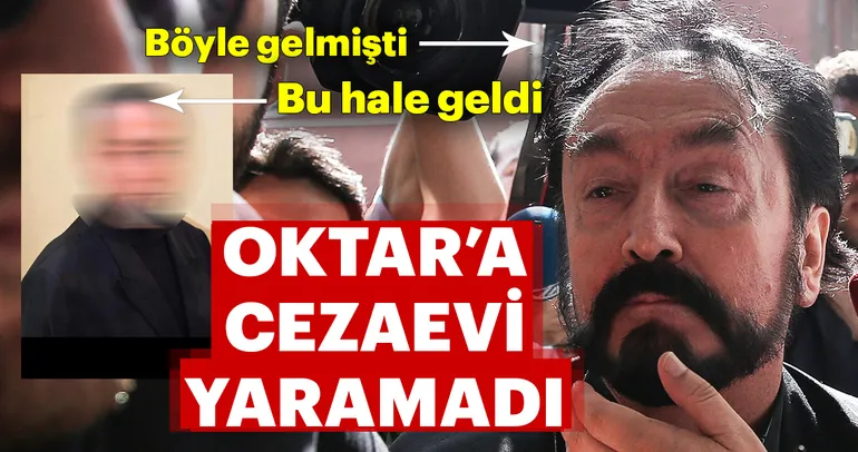 Adnan Oktar'a cezaevi yaramadı