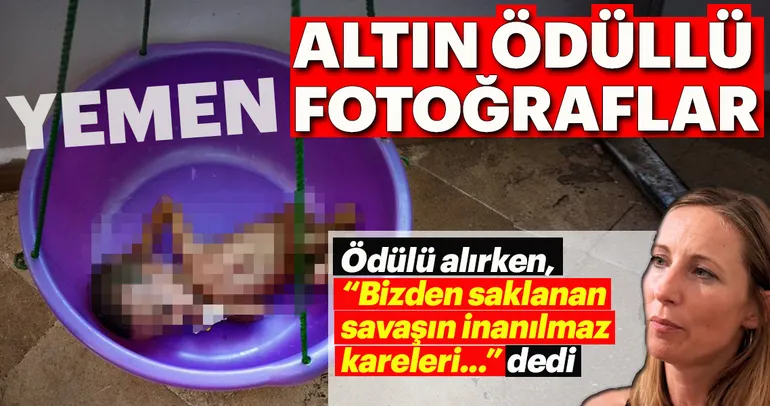 Dehşete düşüren Yemen fotoğrafları
