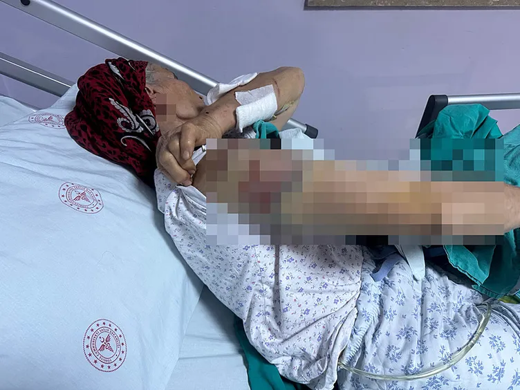 SON DAKİKA... 7 sokak köpeği 65 yaşındaki kadını parçaladı: Vücuduna tam 50 dikiş atıldı!