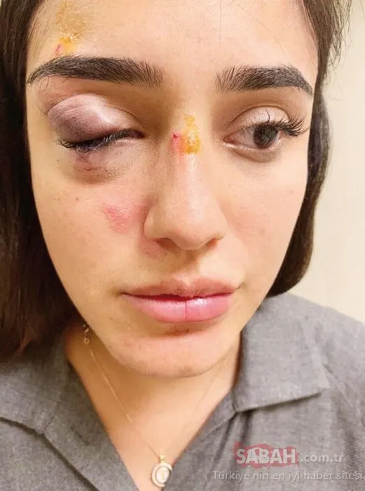 Bebeğinin babası tarafından öldüresiye dövülen Ceren Bebeğinin babası tarafından öldüresiye dövülen Ceren