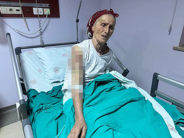 SON DAKİKA... 7 sokak köpeği 65 yaşındaki kadını parçaladı: Vücuduna tam 50 dikiş atıldı!