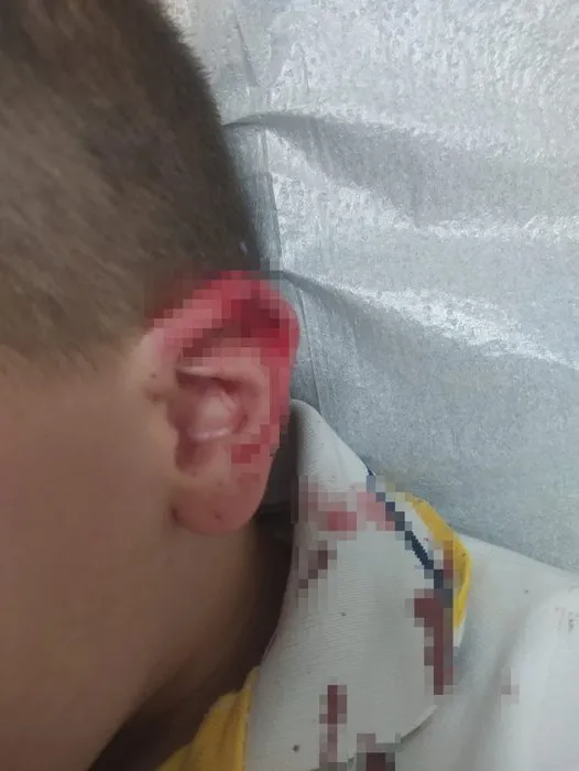 Akran zorbalığı öldürüyordu: 7 yaşındaki çocuğun kulağı kesildi!