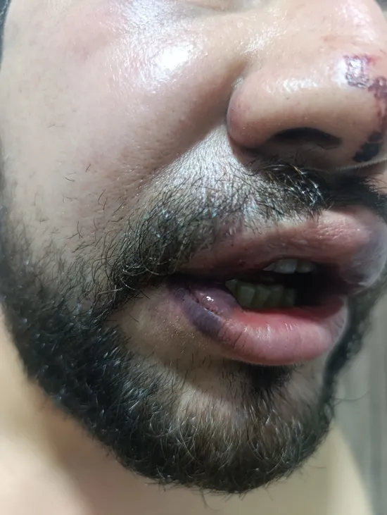 Keçiören Belediyesi'nde öldüresiye dayak skandalı!
