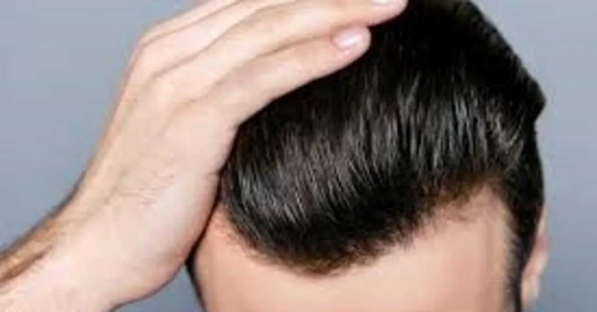 Sac Ekimini Merdiven Alti Yerlerde Degil Hastane Ortaminda Yaptirin Son Dakika Haberler