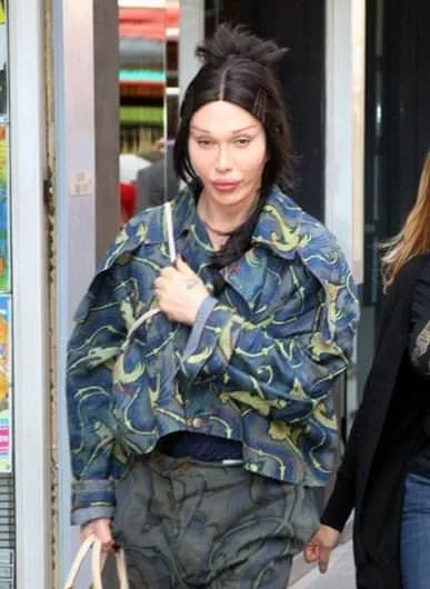 1980'LERİN MÜZİK İKONU PETE BURNS ÖLDÜ