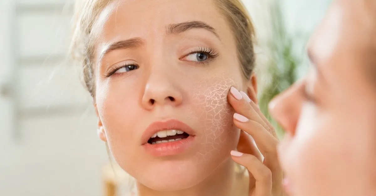 درمان قطعی پوست خشک با چند روش بسیار ساده