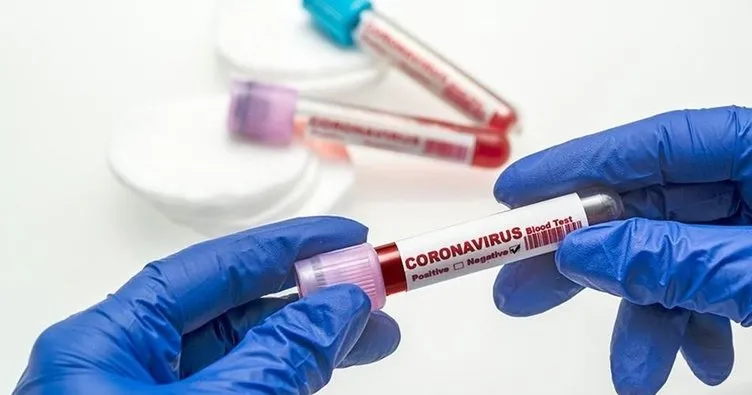 İngiltere’de koronavirüs nedeniyle son 24 saatte 290 kişi hayatını kaybetti