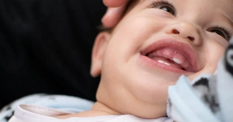 Bebeklerde diş çıkarma serüveni