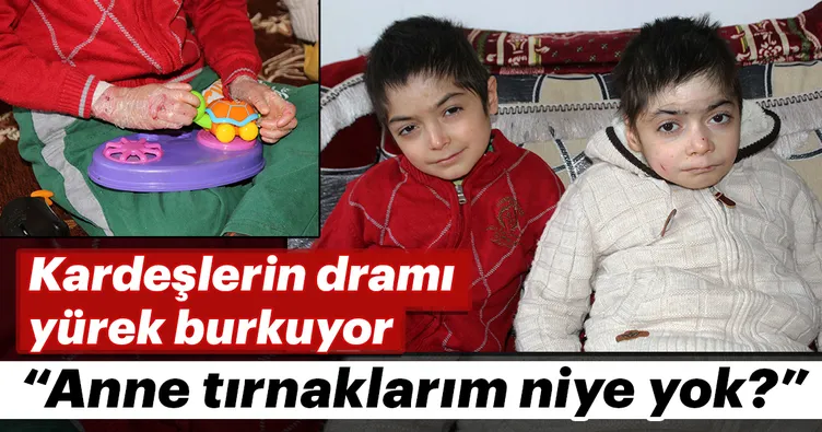 Kardeşlerin dramı yürek burkuyor