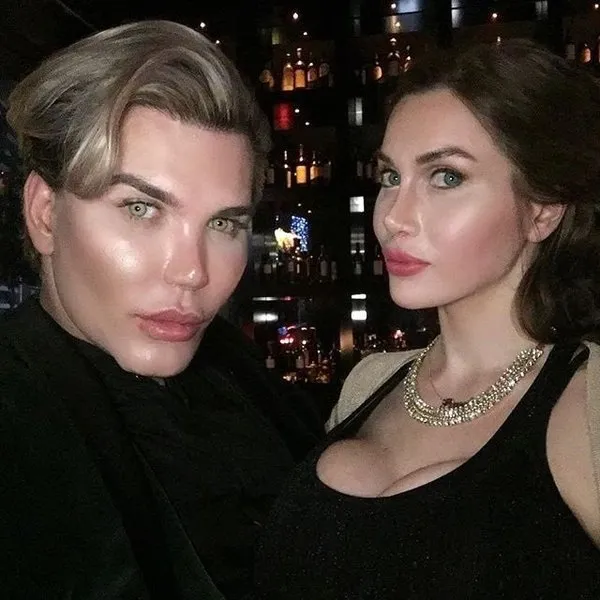 İşte Ken Bebek Rodrigo Alves'in estetiksiz hali