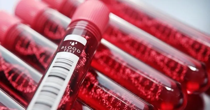 hgb hemoglobin degeri nedir hgb dusuklugu ve yuksekligi ne anlama gelir normal hgb degerleri kac olmali saglik haberleri