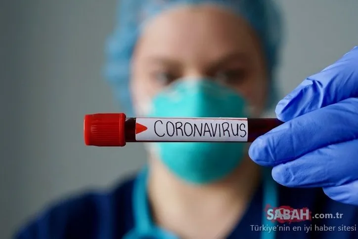 Corona virüsü belirtileri içerisinde yeni bulgular! Alman Bilim insanları açıkladı: Corona virüsü belirtileri...
