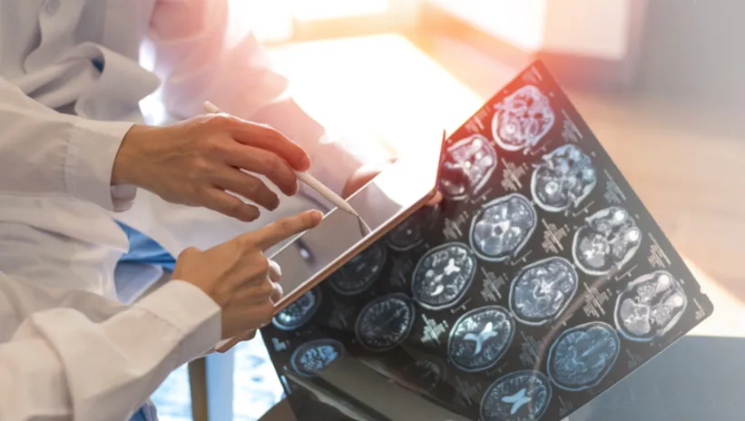 İngiltere’nin konuştuğu Türk kızı Mine! Türk doktorundan tip 2 diyabet ve Ms’e deva olacak araştırma