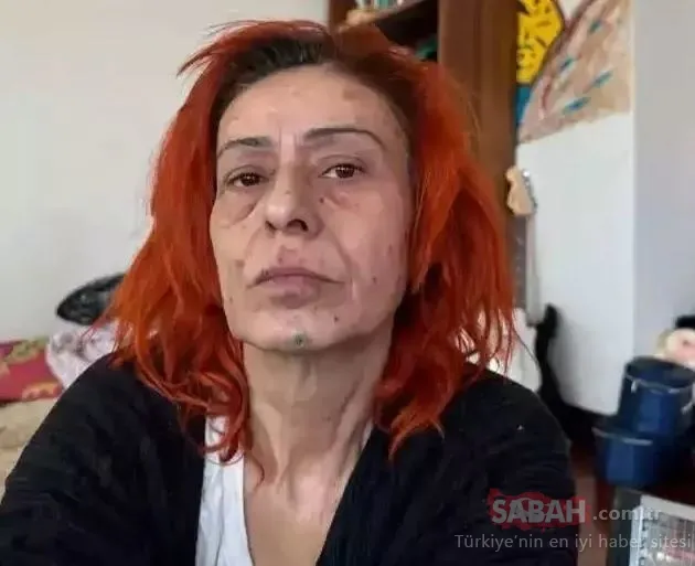 ‘Uyuduğu için yüzü yandı’ iddialarına cevap verdi! Tanyeli’nin gecesinde ortaya çıkan Yıldız Tilbe: Boya kötüymüş!