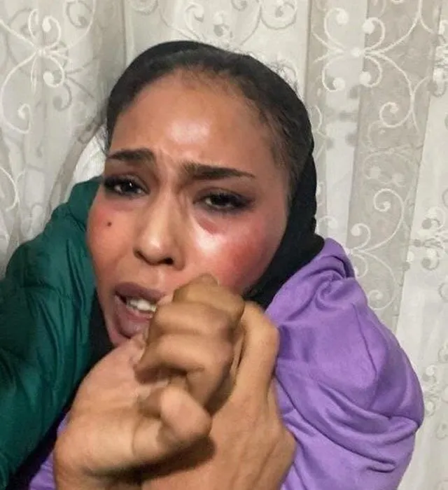 Son dakika | Taksim saldırısında patlamaya ilişkin kritik deşifre: Polis o ismin peşinde