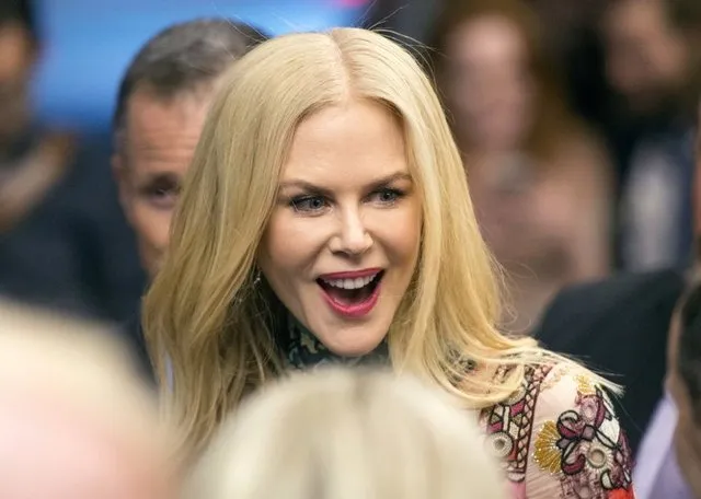 Hollywood yıldızı Nicole Kidman tanınmaz hale geldi!