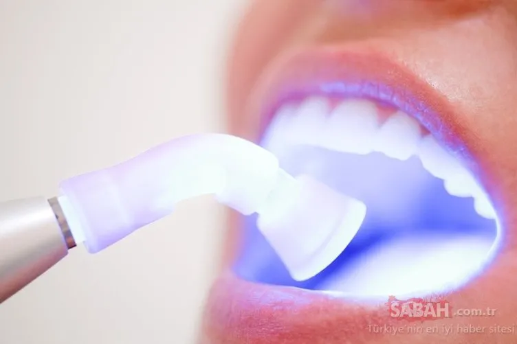Çürük dişler için doğal çözüm!  Çürük diş sorununu ortadan kaldıran besin...