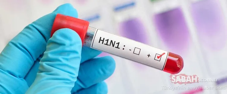 Son dakika haberi! Aksaray’da Corona şüphesiyle kontrol altına alınan Çinli turist H1N1 çıktı! H1N1 virüsü nedir, belirtileri nelerdir ve nasıl korunulur?