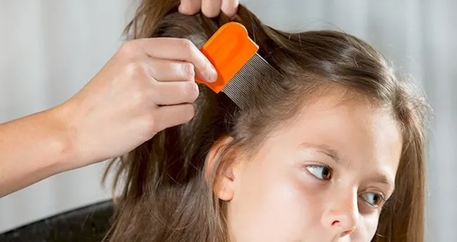 Bit Nasil Olusur Sac Biti Nasil Olusur Uzun Sactan Bit Nasil Yok Edilir Saglik Haberleri Bit Nasil Olusur Sac Biti Nasil Olusur Uzun Sactan Bit Nasil Yok Edilir Saglik Haberleri