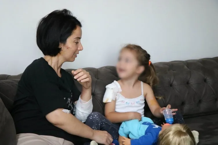 Samsun’da saldırgan köpek dehşeti! Sibel Güven ve kızı ölümden döndü