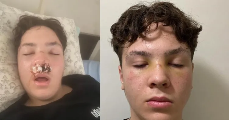 Lise çıkışı kavga: 15 kişi saldırıp burnunu kırdılar!