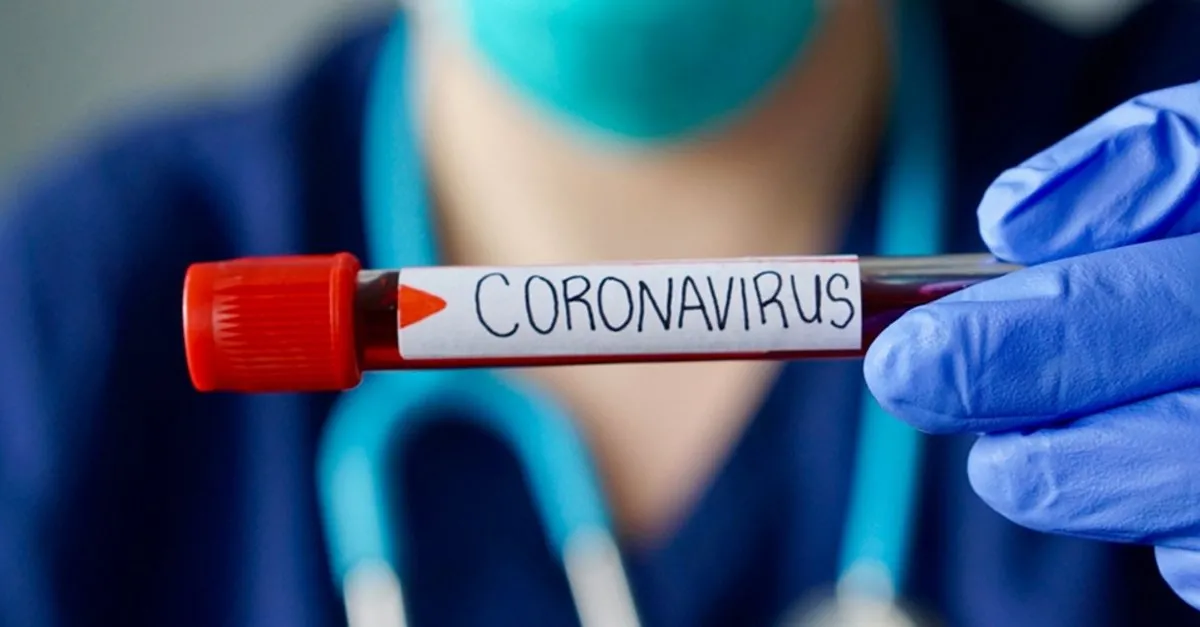 e nabiz giris ile covid 19 test sonucu