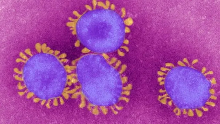 Son dakika! Koronavirüs bir ülkeye daha ulaştı! İlk hasta kaydı yapıldı!