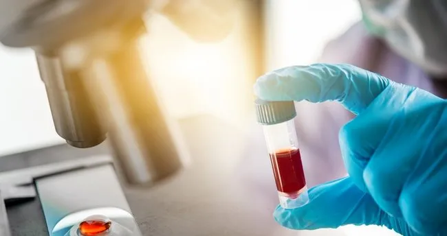 Saglik Bakanligi Antikor Testi Zorunlu Mu Hangi Hastaneler Yapiyor Antikor Testi Ne Zaman Nasil Ve Kimlere Yapilacak Son Dakika Haberler