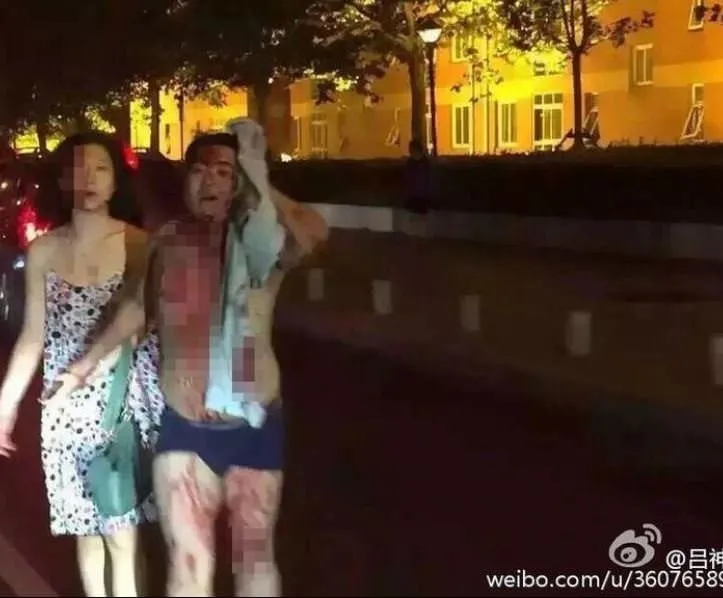 Çin’in Tianjin patlaması sonrası yasakladığı fotoğraflar