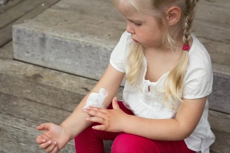 Besin alerjisi olan çocukların sayısı artıyor çünkü…