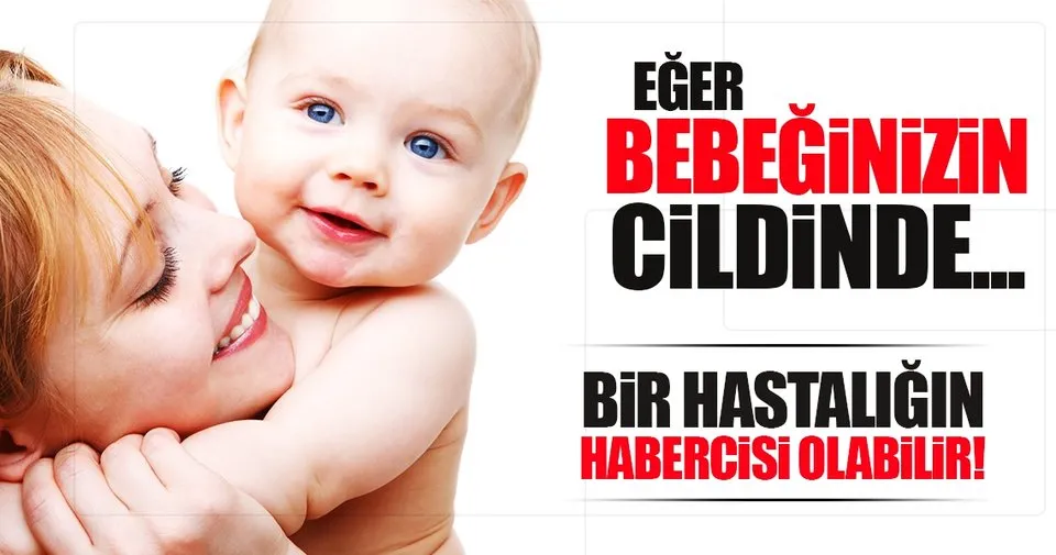 Bebeginizin Cildine Iyi Bakin Bebek Haberleri
