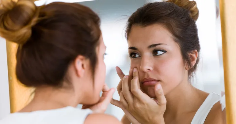 İşte sivilce oluşumunun nedeni...