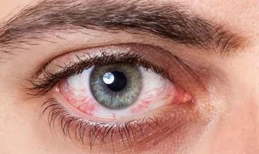 Koronavirüs gözden de bulaşabilir