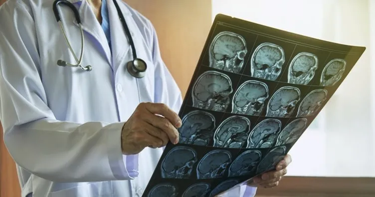 Beyin Cerrahi Neye Bakar? Beyin Ve Sinir Cerrahi Bölümü Nedir, Beyin Ve Sinir Cerrahi Hangi Hastalıklara Bakar ve Hangi Testleri Yapar?