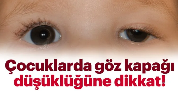 Cocuklarda Goz Kapagi Dusuklugune Dikkat Cocuk Haberleri
