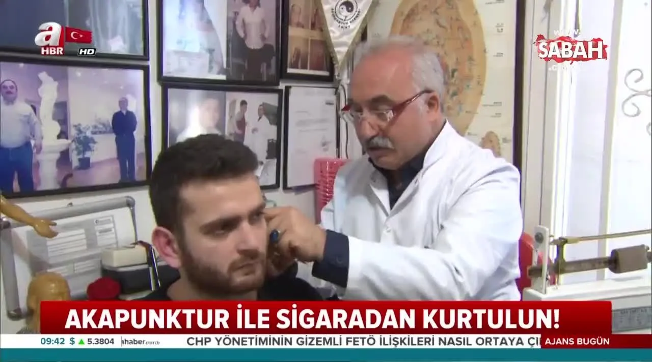 Tek Seansta Sigaradan Kurtaran Cihaz Akupunktur Ile Sigara Birakmak Munkun Mu Videosunu Izle Son Dakika Haberleri