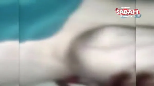 Mısır’da hayatını kaybeden hastanın gözleri çalındı