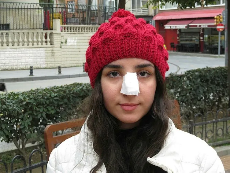 Kadıköy’de 17 yaşındaki kıza yumrukla saldırıda flaş gelişme!
