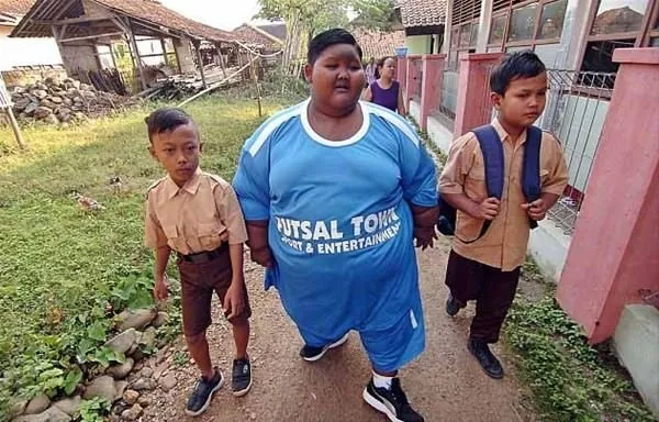 Dünyanın en kilolu çocuğu