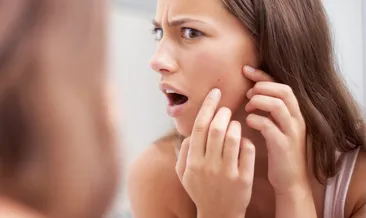 Akne ve sivilcelerden kurtulmak için...