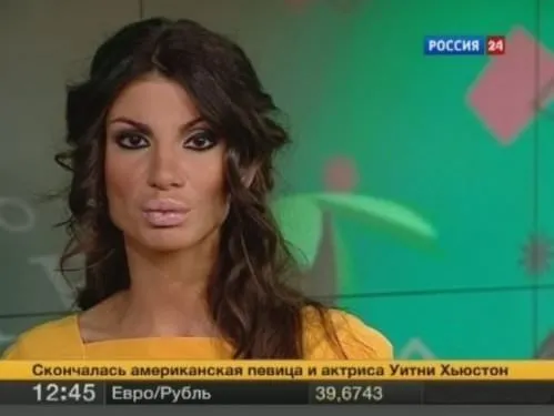 Rusya'da yeni moda Angelina dudağı