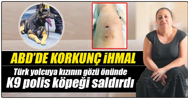 JFK’de Türk yolcuya polis köpeği saldırdı