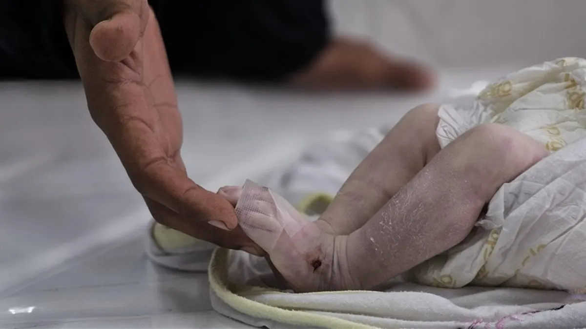 Filistin’deki katliamın en masum kurbanları: Bebeklerin ölümü kahrediyor