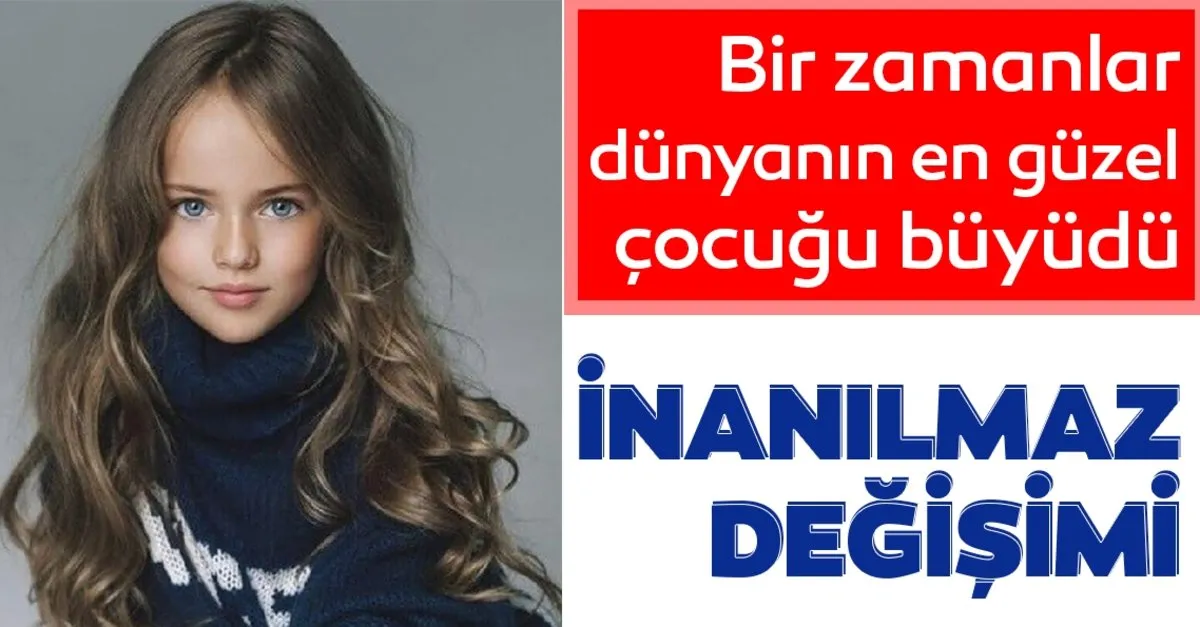 Dunyanin En Guzel Kiz Cocugu Buyudu Iste Inanilmaz Degisimi Son Dakika Haberler