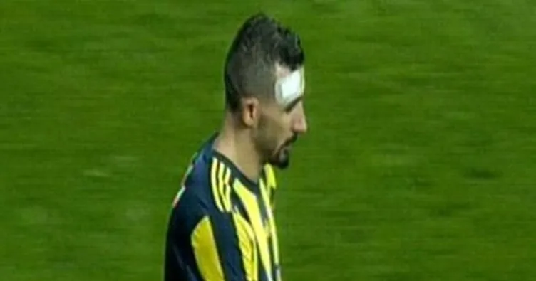 Mehmet Topal başından yaralandı