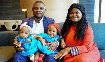 İstanbul’da ayrılan Kamerunlu siyam ikizlerin ailesinden Türkiye’ye teşekkür