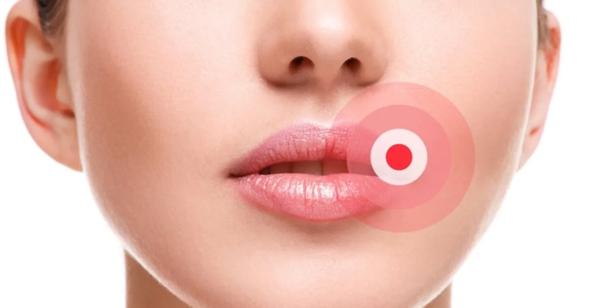 ucuk neden olur hangi vitamin