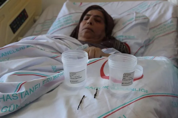 66 Yil Sonra Ortaya Cikan Gercek Doktorlari Saskina Cevirdi Sayfa 11 En Son Haber