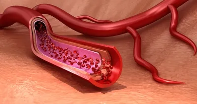 Mucizevi karışım damarları temizliyor!